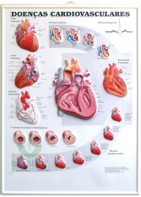 Pôster 3D de Doenças Cardiovasculares em Alto-Relevoog:image